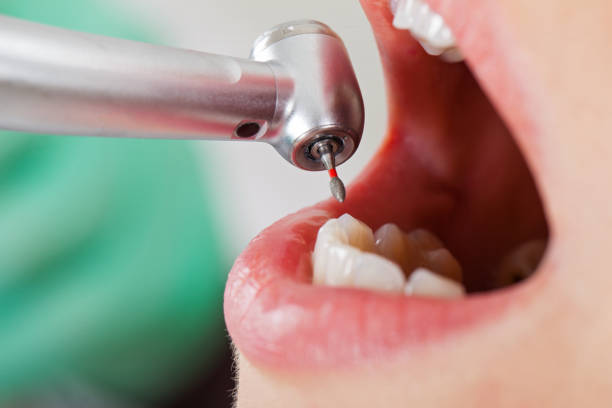 Best Emergency Dental Care for Broken or Chipped Teeth in Sharon Center, OH